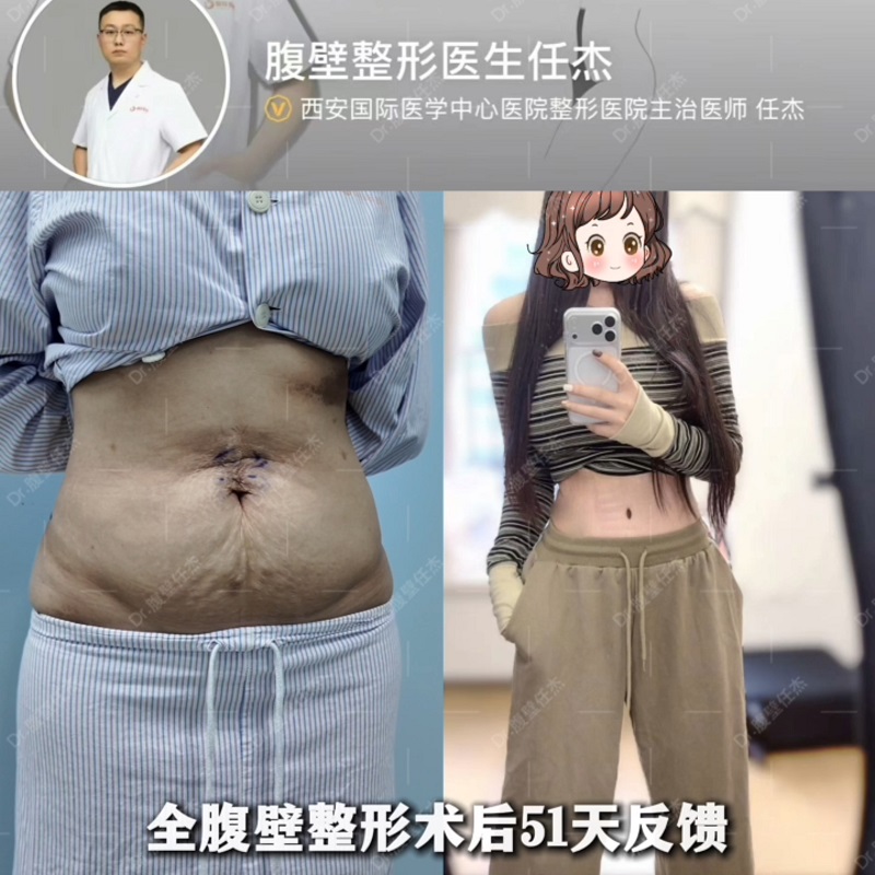 文章插图