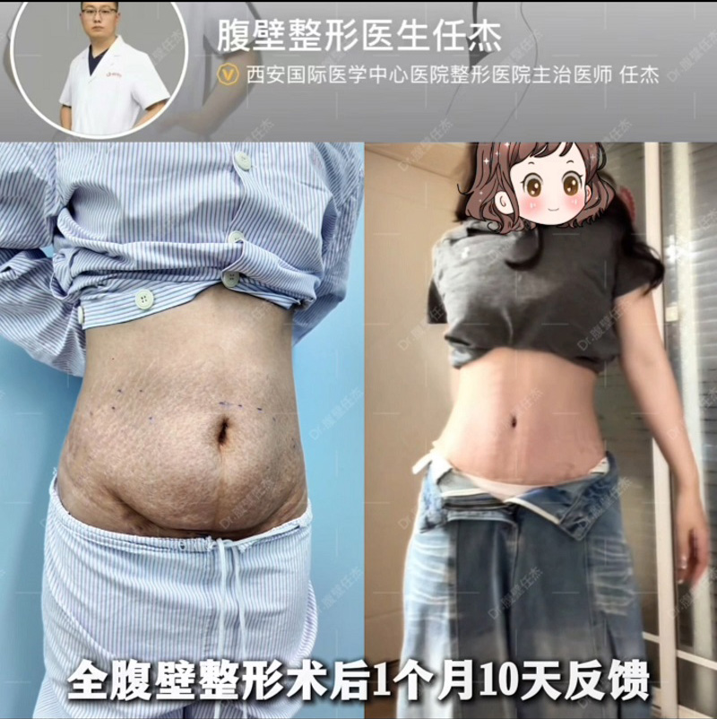 文章插图